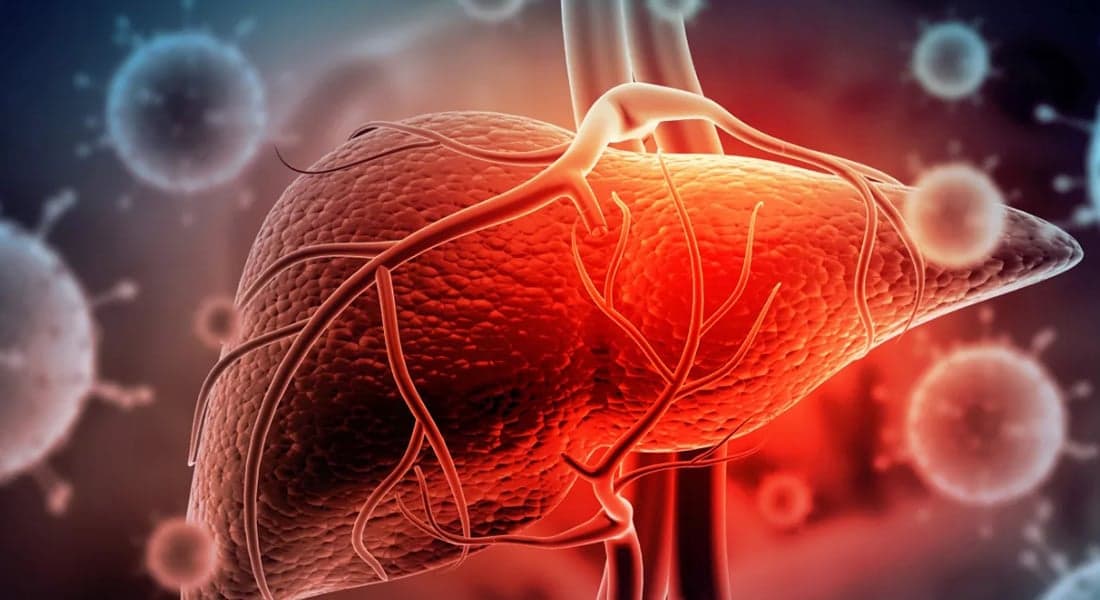 عارض خفي لمشكلات في الكبد